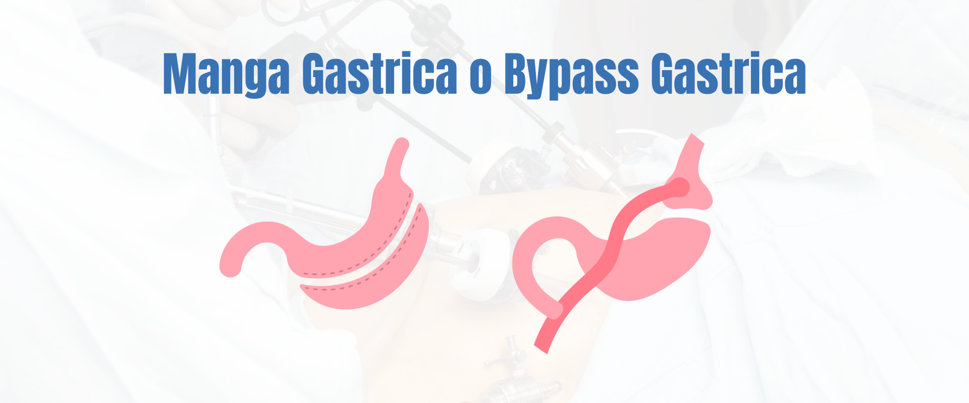 Bypass Gastrico o Manga Gastrica